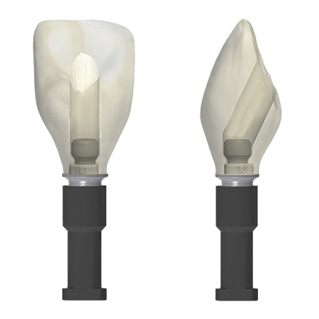 Angulated Screw-Retained