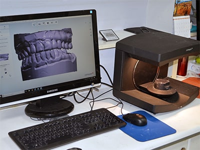 Digital Dentistry Scan