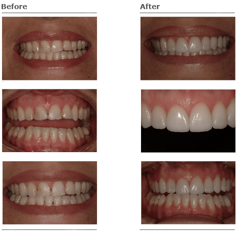 Before & After Gallery Photos
