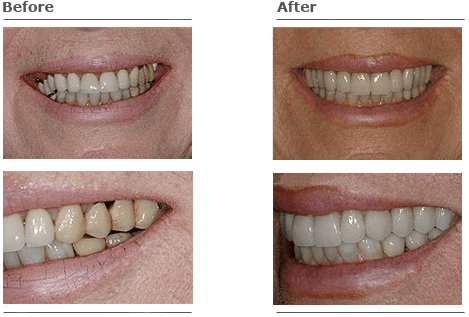 Before & After Gallery Photos