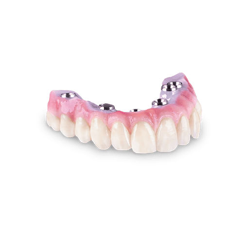 Hybrid Denture